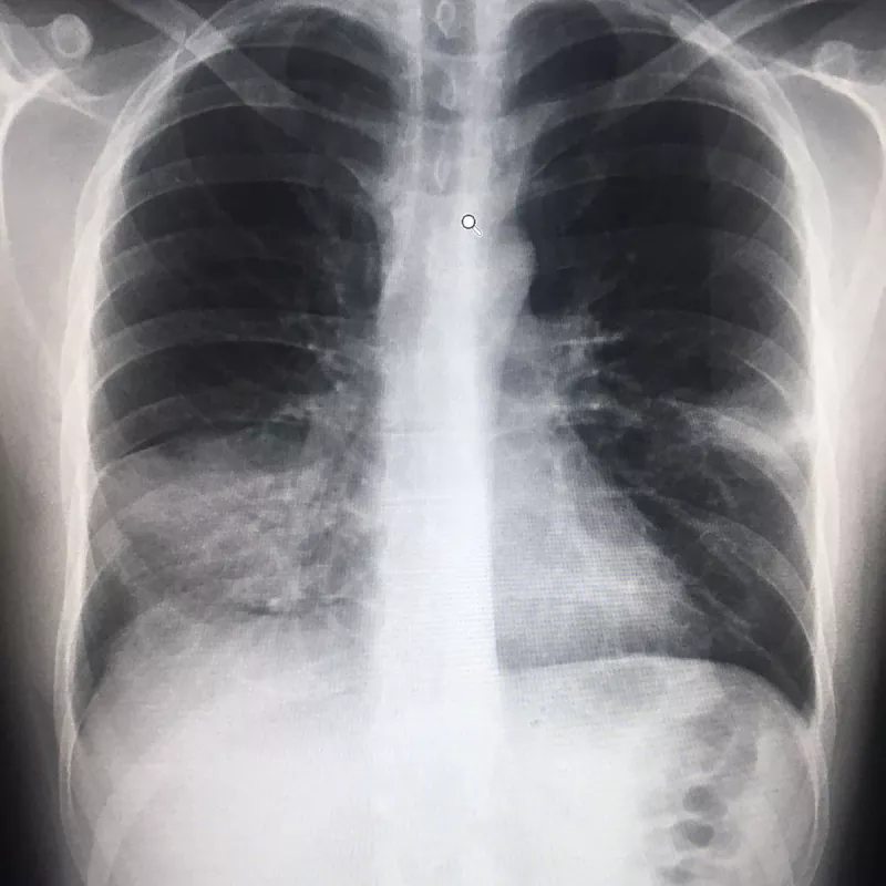 xray